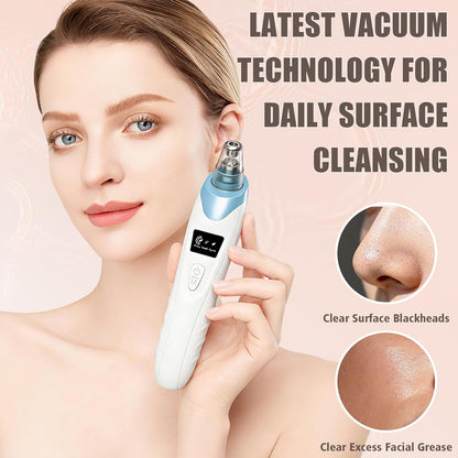 Blackhead Remover Pore Vacuum,Facial Pore Cleaner Blackhead Vacuum (Blue) | 5 Suction Power,5 Probes,Usb Rechargeable Pore Vacuum Tool for Adult