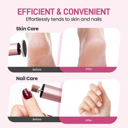 2-In-1 Electric Foot Callus Remover, Self Care Gifts for Women Mom Lover | Professional Pedicure Tool for Feet | 2 Hours Operation | 6 Gears Adjustable Foot File | 1200Mah Rechargeable | 20 Sandpapers